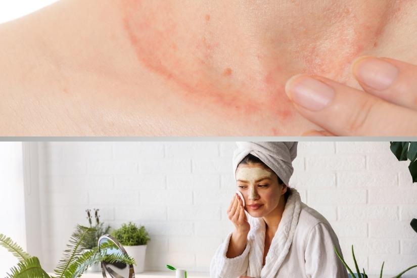 como-prevenir-y-tratar-las-enfermedades-de-la-piel